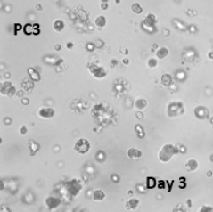 ヒト前立腺がん細胞（PC3）の3D培養